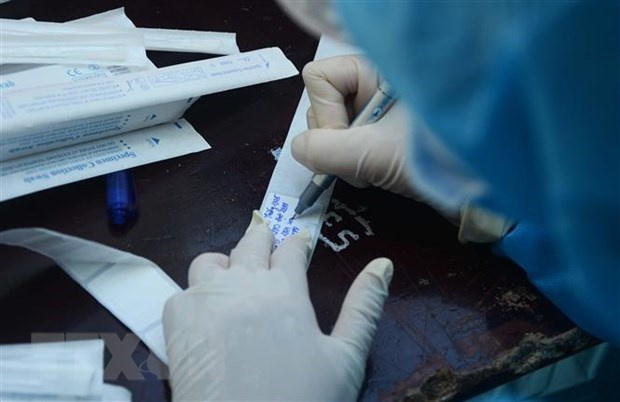 Медицинский персонал пишет информацию на этикетке пробы на COVID-19 (Фото: ВИА)