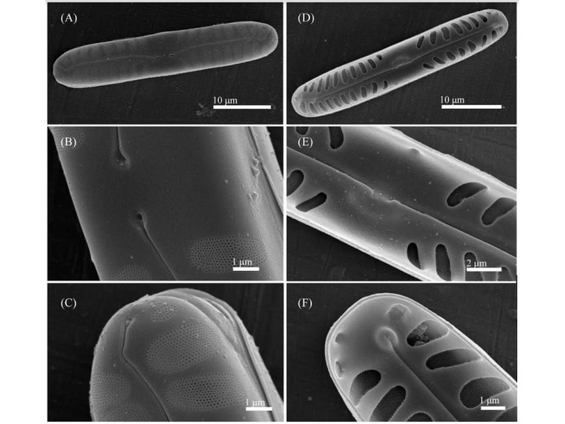 Один из новых описанных видов диатомовых водорослей — Pinnularia paradubitabilis. Микрофотография сделана с помощью сканирующего электронного микроскопаKezlya et al./Cells, 2022